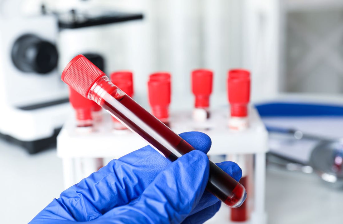 Was Gamma-GT, Harnstoff und Haemoglobin wirklich sagen